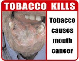 India 2007 Health Effects Mouth - mouth cancer, gross